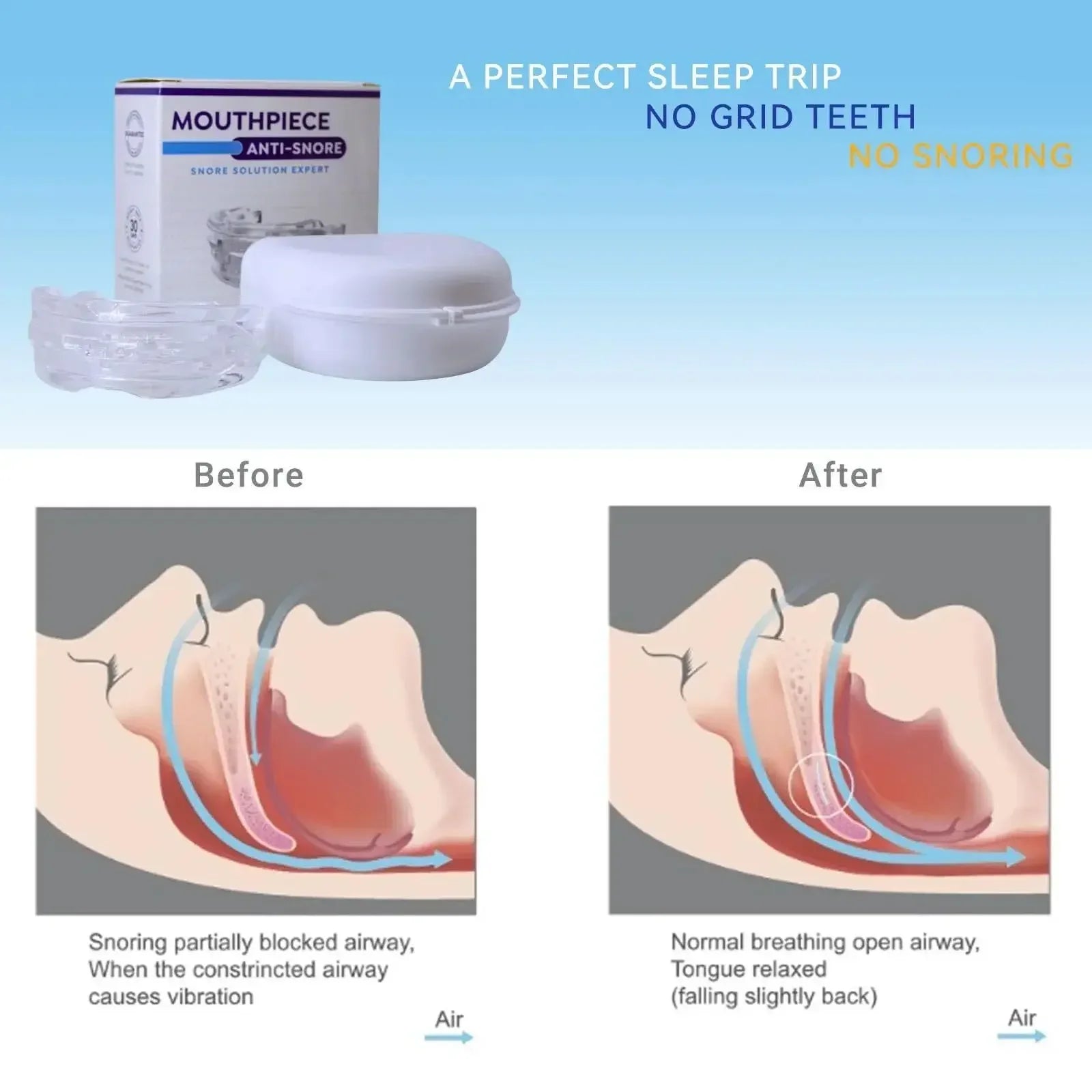 AirAlign™ Anti-Snoring Mouthpiece