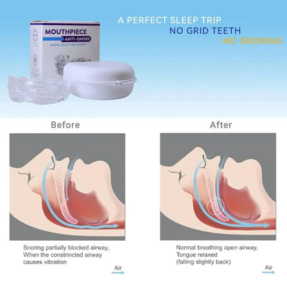 Adjustable Anti-Snoring Mouth Guard  Mouthpiece Sleeping Devices Bruxism Snoring Stopper Improve Sleep Mouthpiece